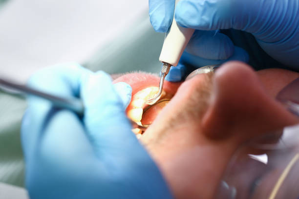 Best Emergency Dental Care for Broken or Chipped Teeth in Ormond By The Sea, FL
