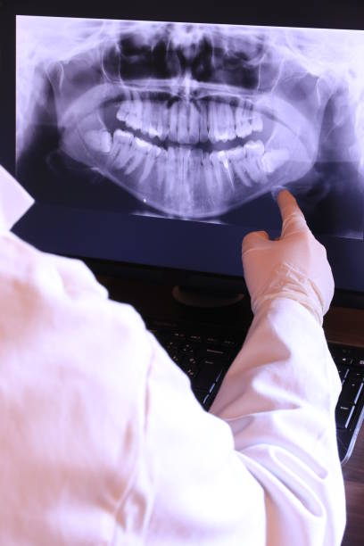 Best Emergency Treatment for Dental Infections or Abscesses in Ormond By The Sea, FL