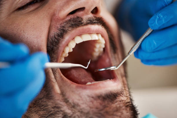Best Same-Day Emergency Dental Services in Ormond By The Sea, FL